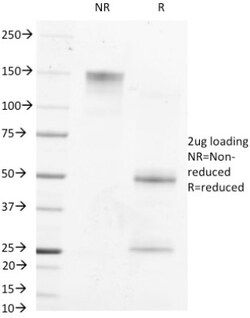 alpha-Fetoprotein/AFP Antibody (MBS-12), Novus Biologicals 0.2mg; Unlabeled:Antibodies,